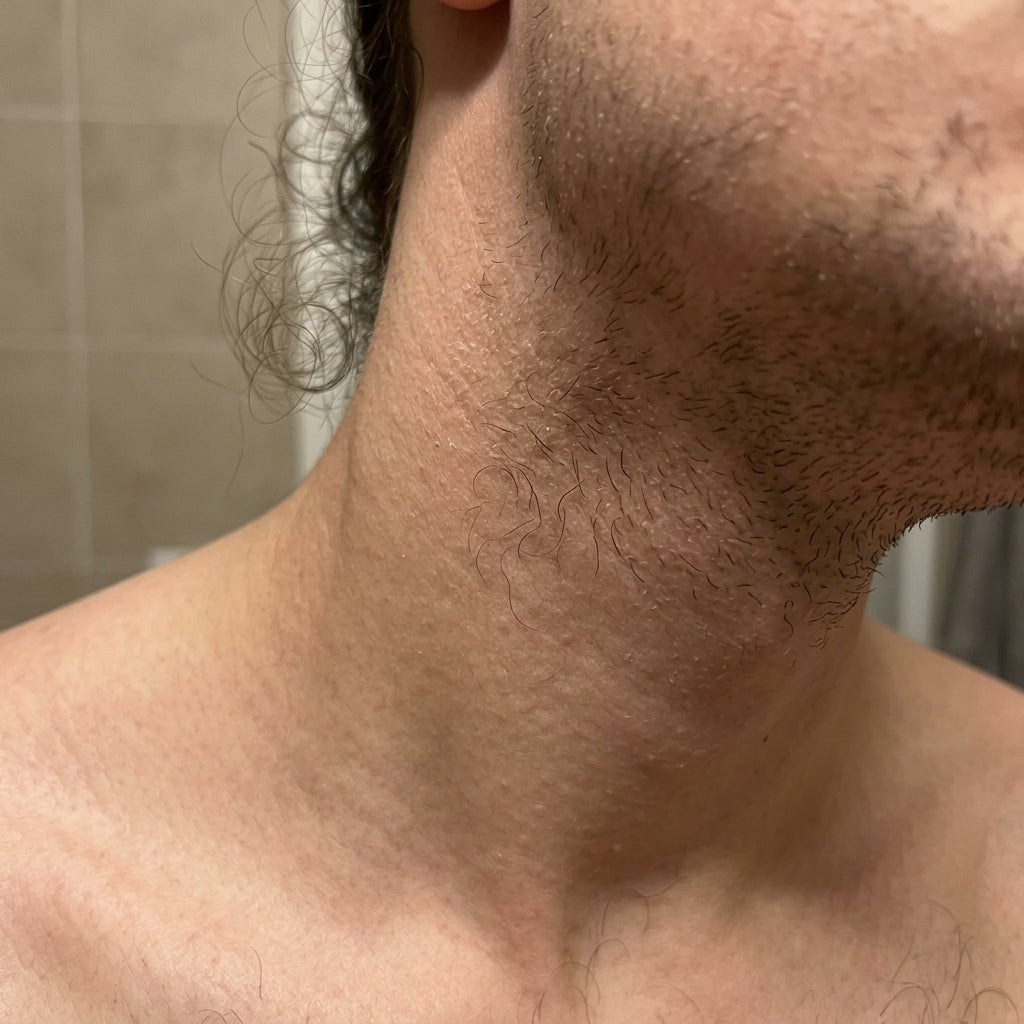 Before